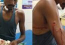 पाण्डुका में तेंदुए ने किया ग्रामीण पर हमला, गंभीर