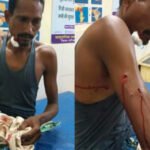 पाण्डुका में तेंदुए ने किया ग्रामीण पर हमला, गंभीर
