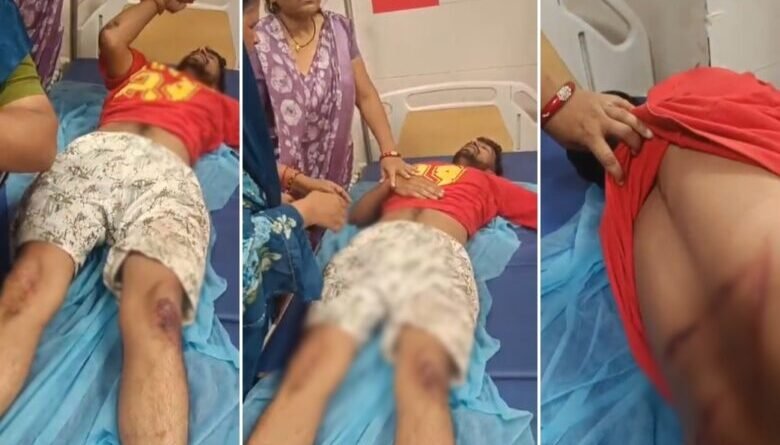 शराब के लिए पैसे मांगने पर विवाद, विधायक के बेटे से मारपीट